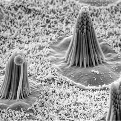 Mechanotransduction