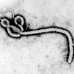 Ebola in da Area (Mental Acid Tekno 160 Bpm)