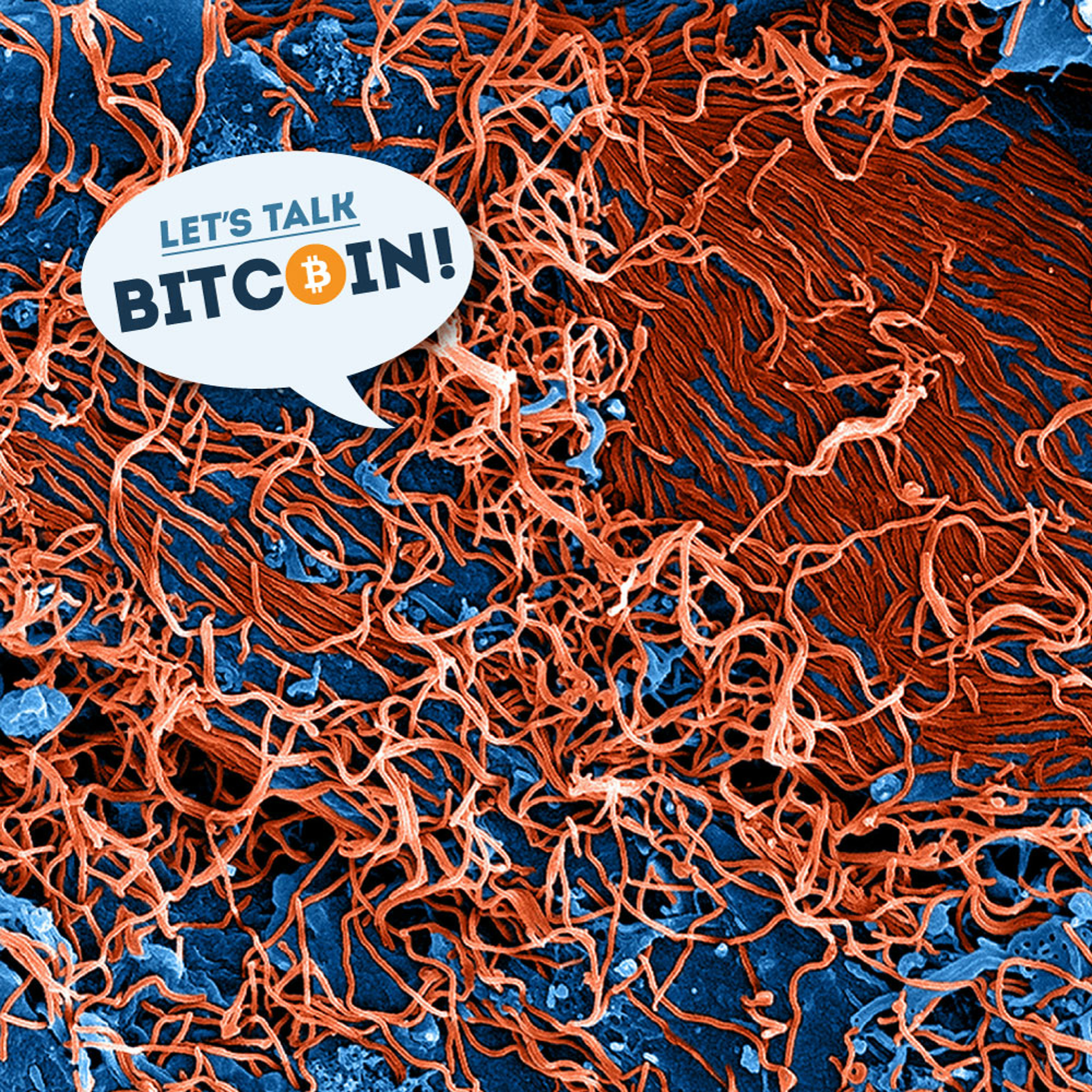 LTB E158 - Ebola and the Body Blockchain