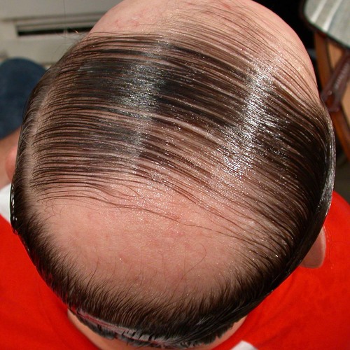 COMB THE  TUFT FROM THE LEFT HAND SIDE (BUT DON'T PASS THE DUTCHIE)