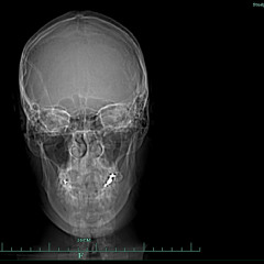 Blackstreet Parov - No Diggity All Night (mashed Deeply with Balls)