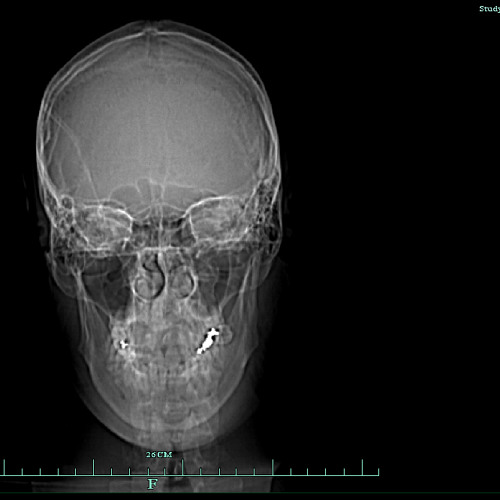 Blackstreet Parov - No Diggity All Night (mashed Deeply with Balls)