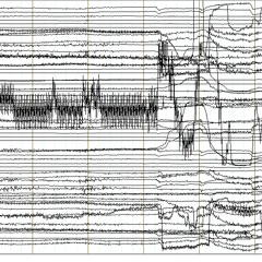 Anatide acousmonium. Stralci di un racconto incomponibile. N°1
