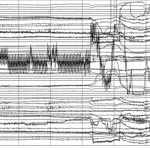 Anatide acousmonium. Stralci di un racconto incomponibile. N°1