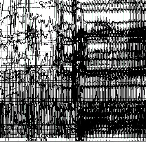 Anatide acousmonium. Stralci di un racconto incomponibile. N°3