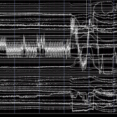 Anatide acousmonium. Stralci di un racconto incomponibile. N°2