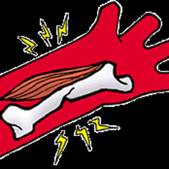 2 de 2 ¿Cuáles son los accidentes más comunes que se presentan en los niños dentro del hogar?