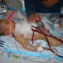 I AM ECMO and this is my story +freedownload+ #DISTRICTDOJO