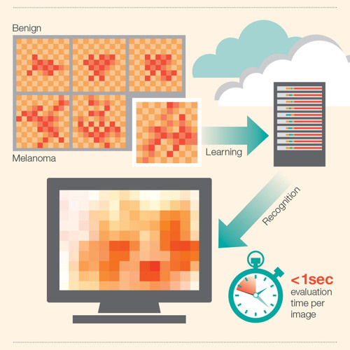 Using Cognitive Computing to Visually Analyze Skin Cancer
