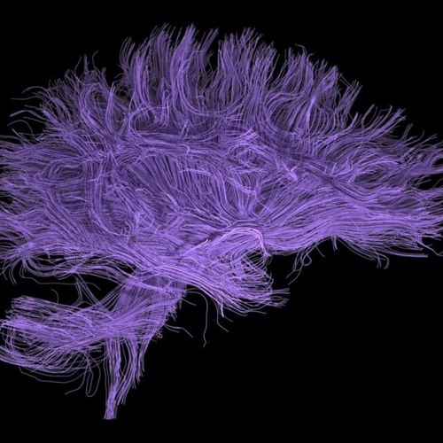 Confirmation Bias (Demo)