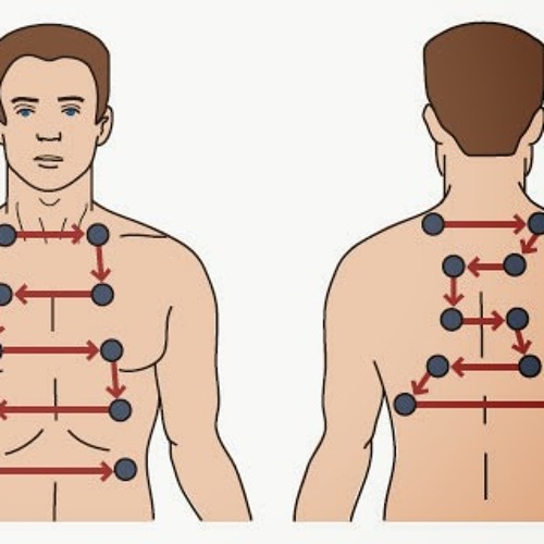 Stream Bronchial Breath Sounds Heard Over Lung Consilidation by