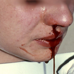 8en - -KJD Sessions 2 - -Nosebleed