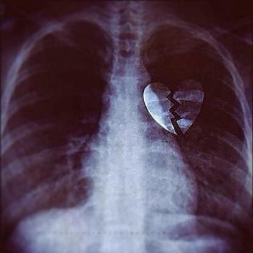 Loreen - My Heart Is Refusing Me (Radio Killer Remix)