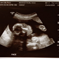 "Life Trance": Baby's HeartBeat: Dec. 15, 2014.MP3