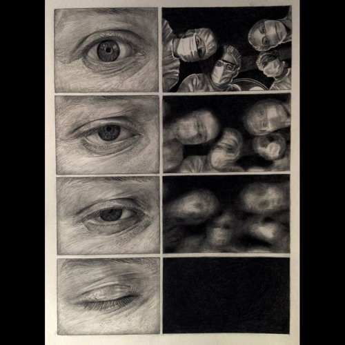 Аноним - Трепанация