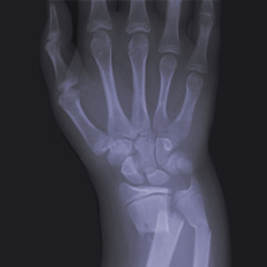 WristBreak (Young Rose, J Mike, Alfie C, Dev Lingo) Prod. Yung Gleesh