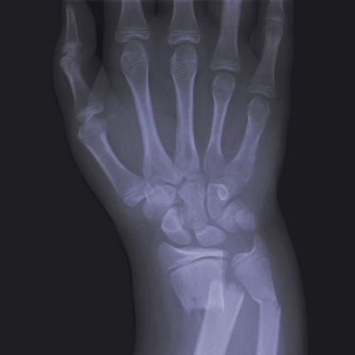 WristBreak (Young Rose, J Mike, Alfie C, Dev Lingo) Prod. Yung Gleesh