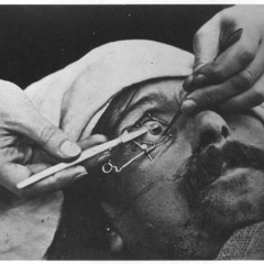 Barry Donovan - Theories Of Insomnia