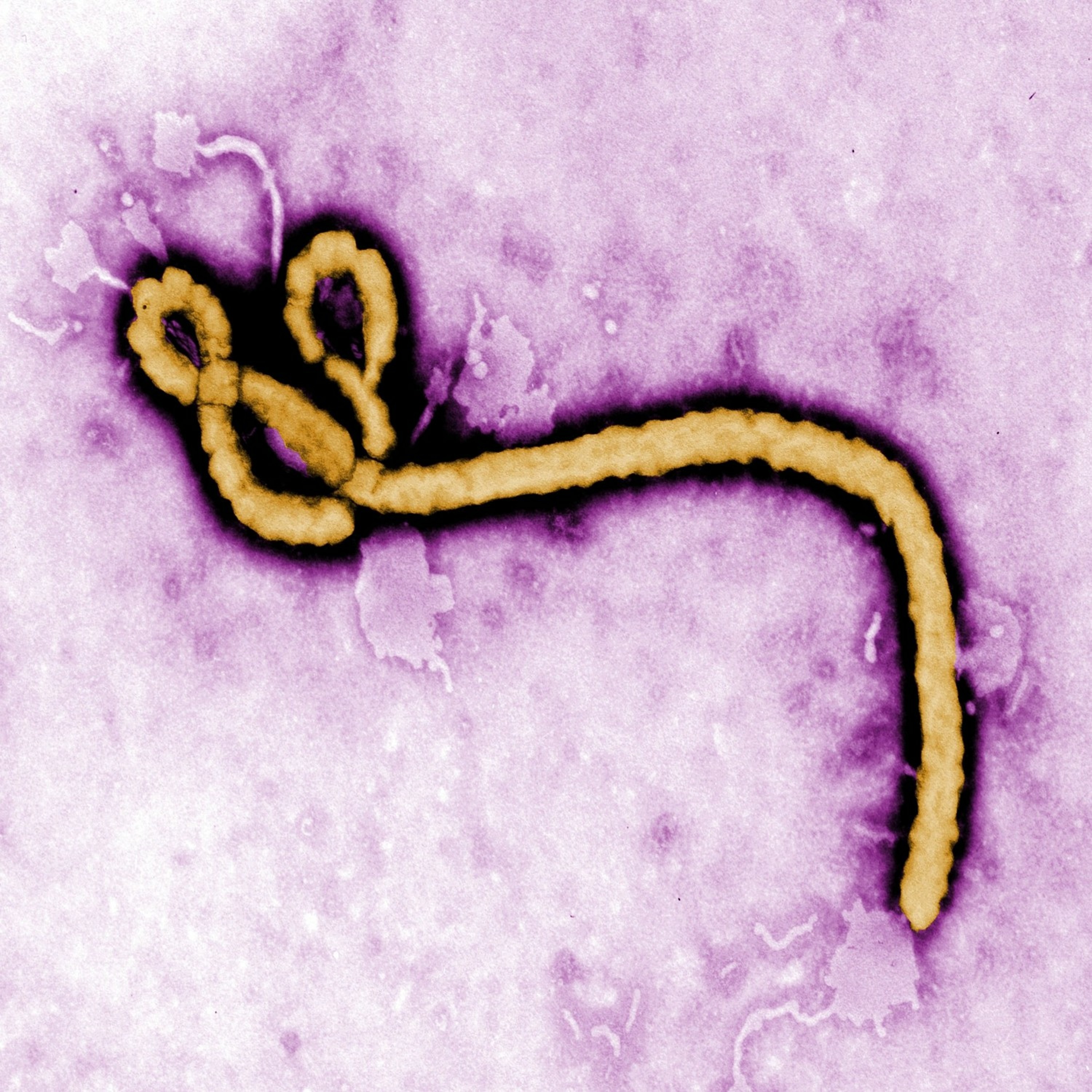 Ébola, el virus que pone contra las cuerdas al mundo