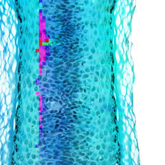 thermia