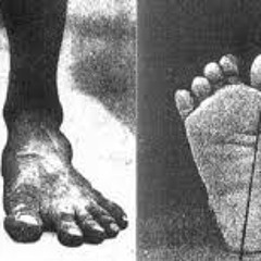 STBB [ Lost Sole ] 415