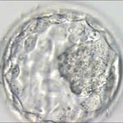 Snog vs. Snake River Conspiracy - Breed [Genethics Mix]