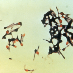 cassette fragments
