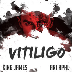 Vitiligo (ft. ARI)