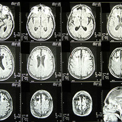 Trastorno Tripolar - Donsi, Pol y Maniyeah (over Ironic)2014