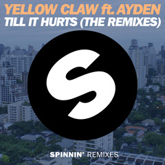 Yellow Claw ft. Ayden - Till It Hurts (The Remixes) [Out Now]