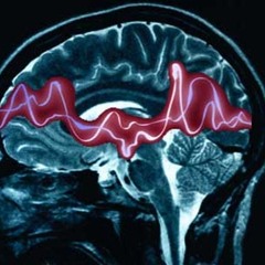 Crise d'épilepsie (vidéo link in description)