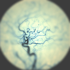 Odesza feat. Jenni Potts - White Lies (Nesley Remix)