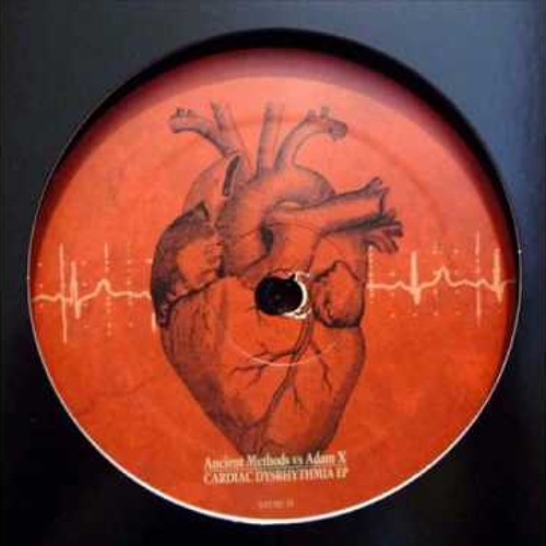 Ancient Methods vs. Adam X - Proarrhythmia (Ancient Methods Mix)