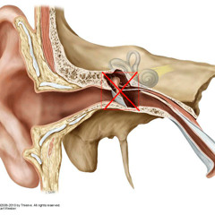 Ear Damage
