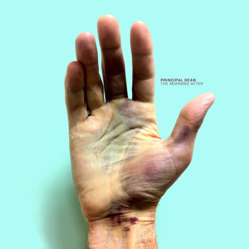 Principal Dean & Thomas White - Sprung (NEST HQ PREMIERE)