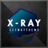 Lee x Matthews - X-ray