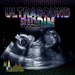 01 Kalado - Now Or Never (EXPLICIT)