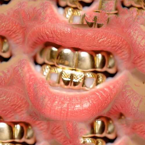 Redlight - Gold Teeth (CalsOnAcid Remix)FREE DL