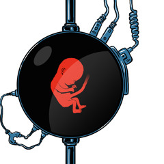 A Womb Away from Home