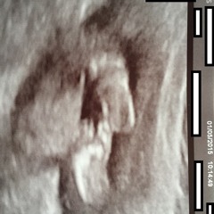 Chitchat Dad Ep4 Pt.2 - Forming a vagina