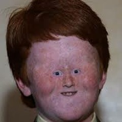 gingers