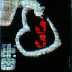 Sophisticated at CoCo (Remix)