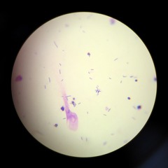 Variatione1