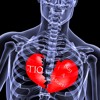 T10 - Buy A Heart (Freestyle)