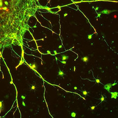Microtubule Vibrations - Sensations