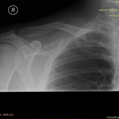 Fight For Flight (I Felt It All)