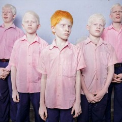 un albinos gros crados