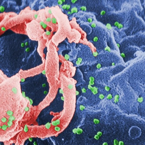 HIV Remission July20