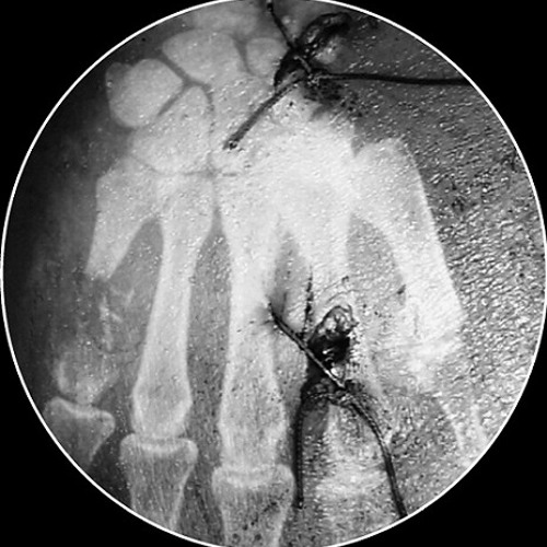 SMK - Mental Breakdown