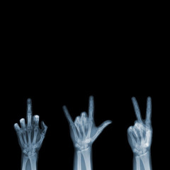 See ThrU ft. Catalyst Bars